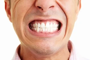 دندان قروچه، علل و خطرات آن